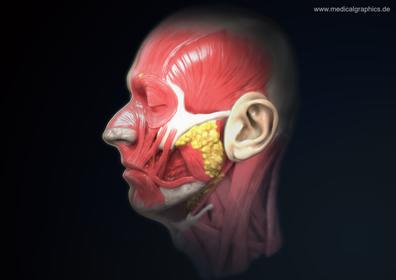 (Image MedicalGraphics)
