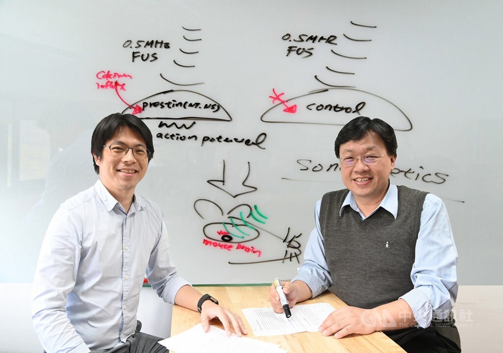 Les ultrasons pour soigner Parkinson (photo fournie par l'Université Tsing Hua)