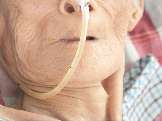 Taïwan interdit l’importation de tubes nasogastriques produits en Chine