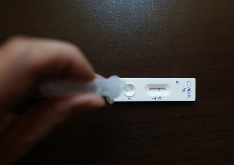 Covid-19 : le dépistage obligatoire seulement en cas de symptômes